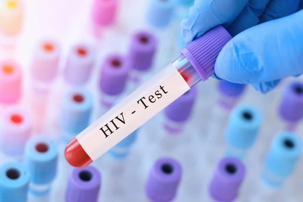 HIV Screening